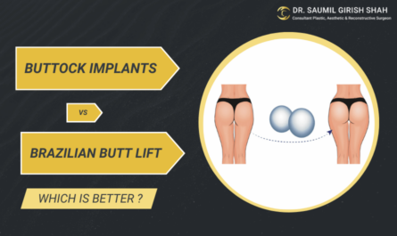 Buttock Implants vs. Brazilian Butt Lift: Which Is Better?