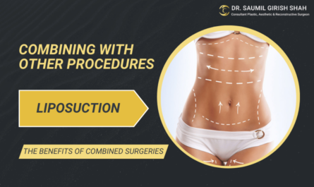 Combining Liposuction with Other Procedures: Is It Safe?