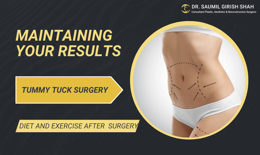 Diet and Exercise After Tummy Tuck Surgery: Maintaining Your Results