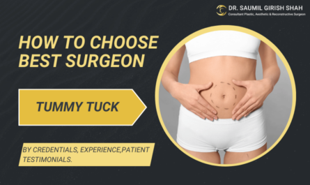 How to Choose the Best Surgeon for Your Tummy Tuck