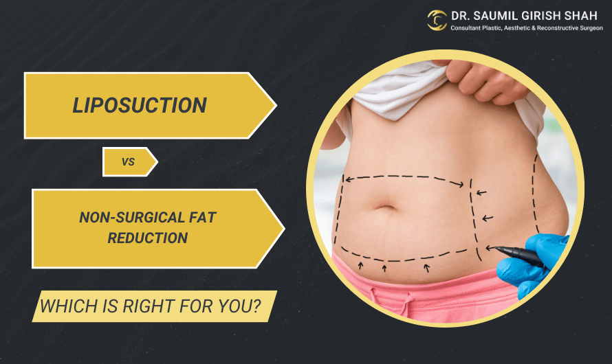 Liposuction vs. Non-Surgical Fat Reduction: Which Is Right for You?