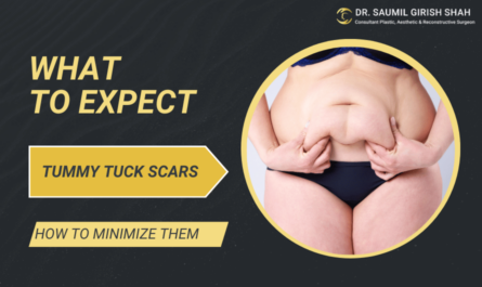 Tummy Tuck Scars: What to Expect and How to Minimize Them