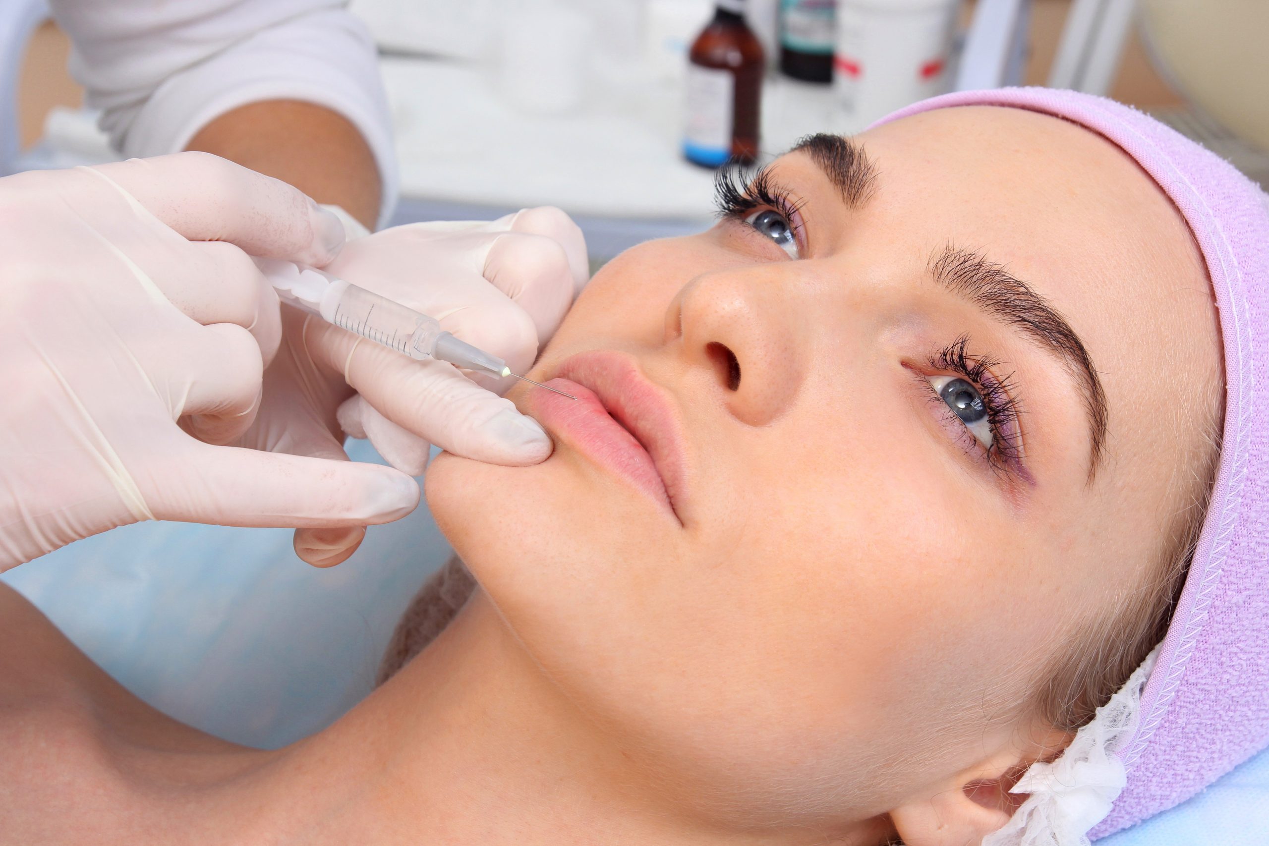 Dermal Fillers