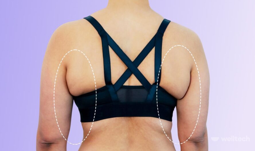 Discover the Ultimate Guide to Bra/Back Lift: Everything You Need to Know