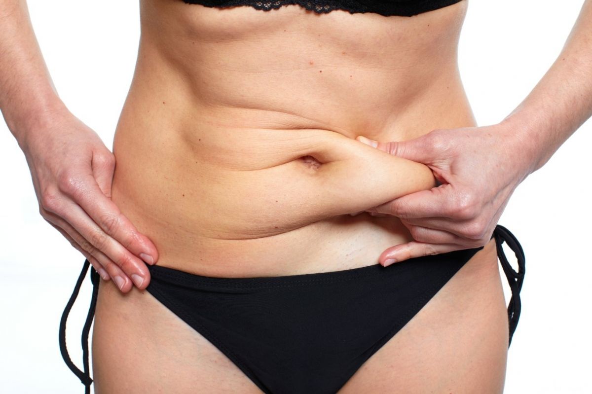 Tummy Tuck (Abdominoplasty)