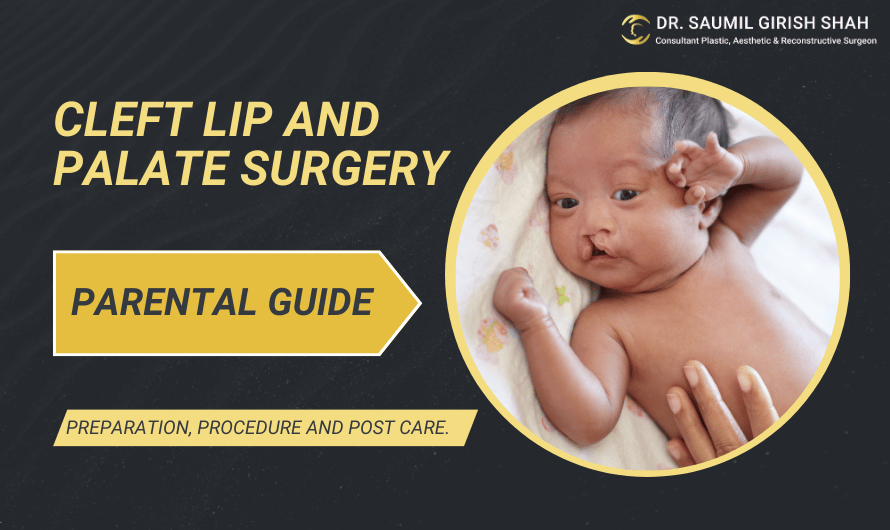 A parental guide to cleft lip and palate surgery