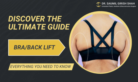 Discover the Ultimate Guide to Bra/Back Lift: Everything You Need to Know