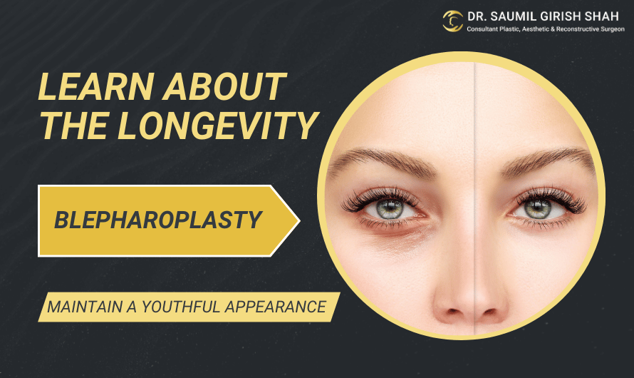 How Long Does Blepharoplasty Last?