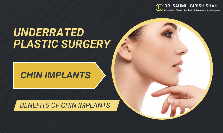 Underrated Plastic Surgery: Chin Implants