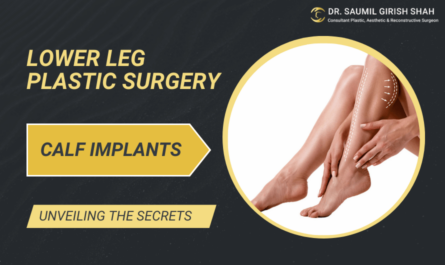 Unveiling the Secrets of Calf Implants: A Comprehensive Guide to Lower Leg Plastic Surgery