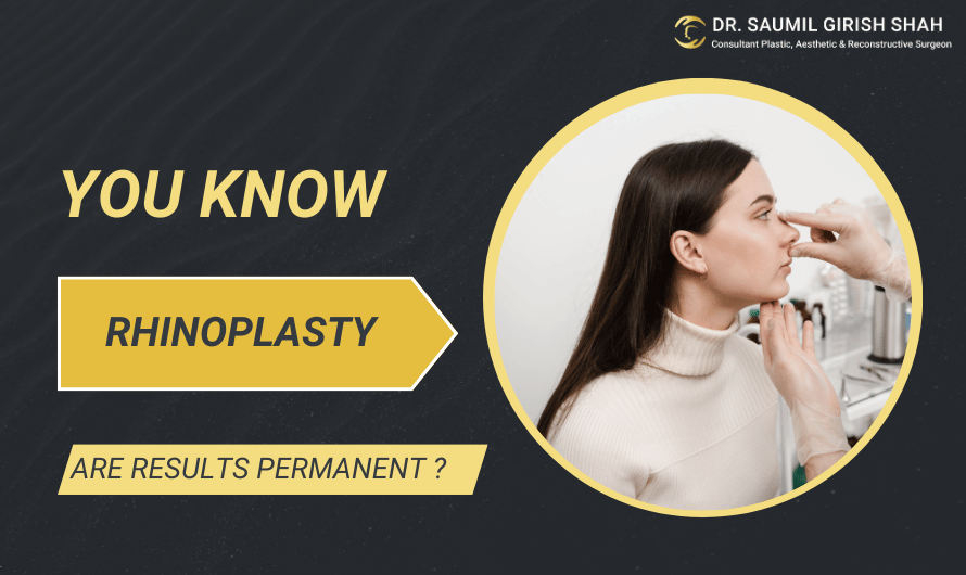 Are Rhinoplasty Results Permanent ?