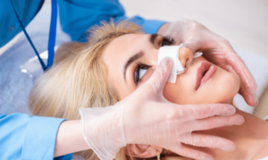 Understanding Rhinoplasty: The Basics