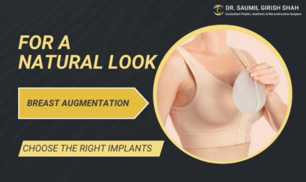 Breast Augmentation Surgery: How to Choose the Right Implants for a Natural Look