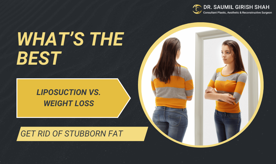 Liposuction vs. Weight Loss: What’s the Best Option to Get Rid of Stubborn Fat?