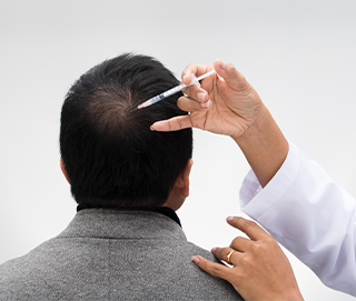 Combination of PRP and Hair Transplant