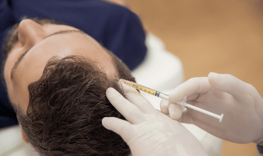 PRP treatment with Dr. Saumil Shah