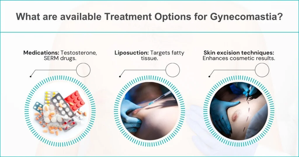 Gynecomastia Treatment Options