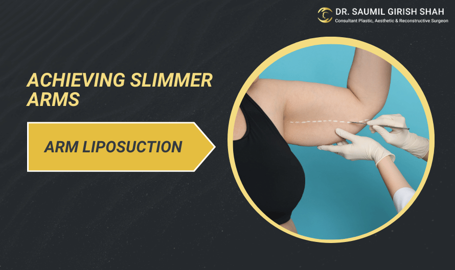 Achieving Slimmer Arms: How Arm Liposuction Targets Stubborn Fat