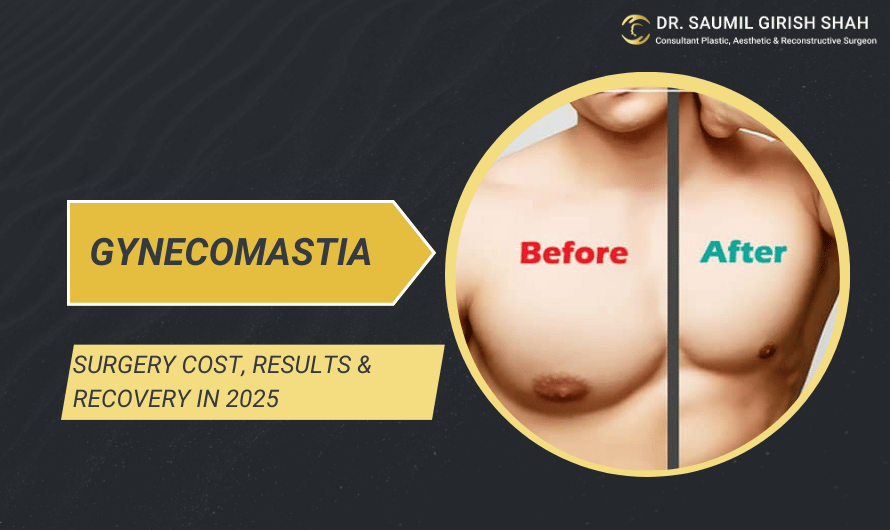 Gynecomastia Surgery: Cost, Results & Recovery in 2025