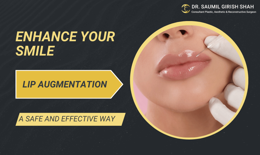 Lip Augmentation: A Safe and Effective Way to Enhance Your Smile
