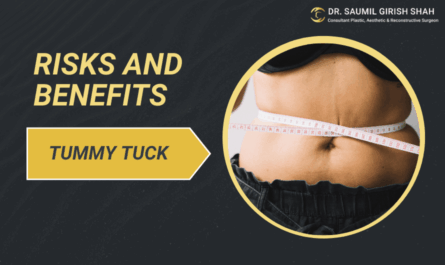 Is Tummy Tuck Surgery Safe? Understanding Risks and Benefits