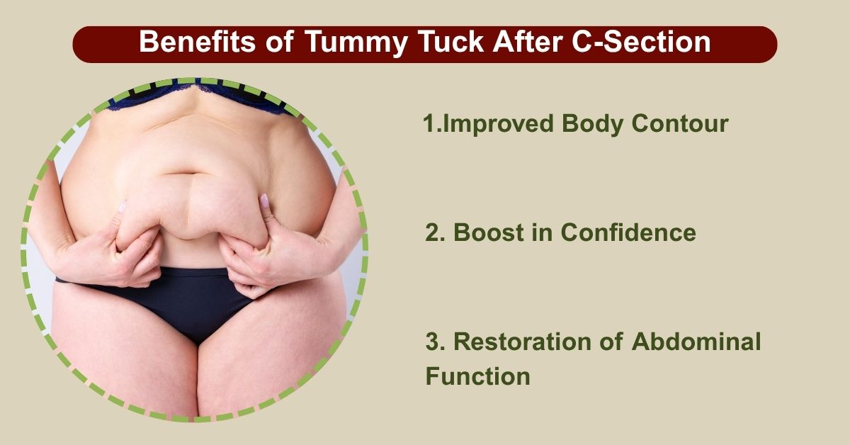 Benefits of Tummy Tuck After C-Section in Mumbai with Dr. Saumil Shah
