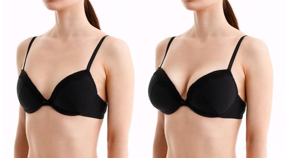 Factors Influencing the Cost of Breast Implants in India