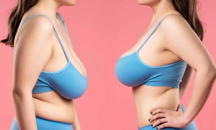 Breast Lift Surgery Cost in India