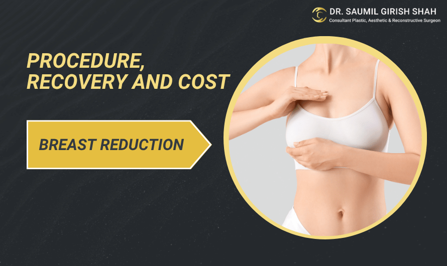 Breast Reduction Surgery: Procedure, Recovery, and Cost