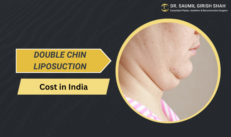 Double Chin Liposuction Cost in India