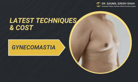 Gynecomastia Surgery in Mumbai 2025: Latest Techniques & Cost