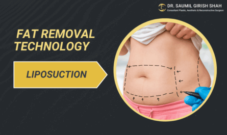 Liposuction in 2025: What’s New in Fat Removal Technology?