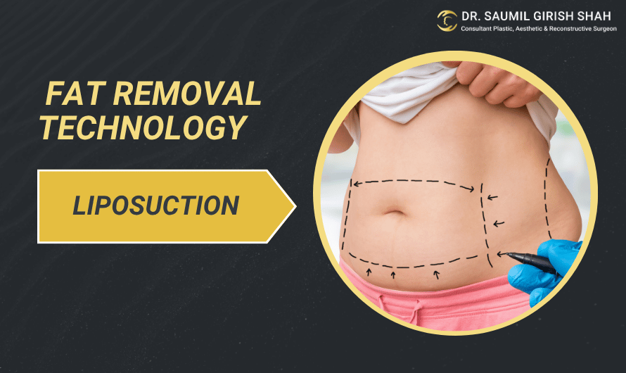 Liposuction in 2025: What’s New in Fat Removal Technology?