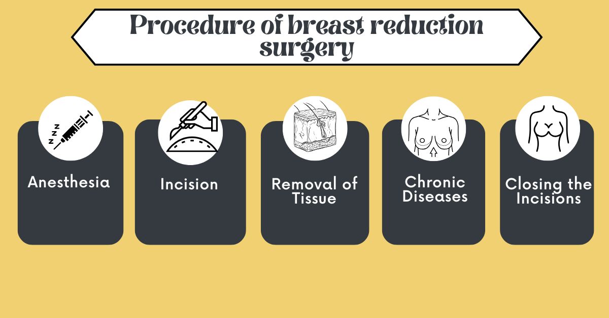 Procedure of breast reduction surgery in Mumbai with Dr. Saumil Shah