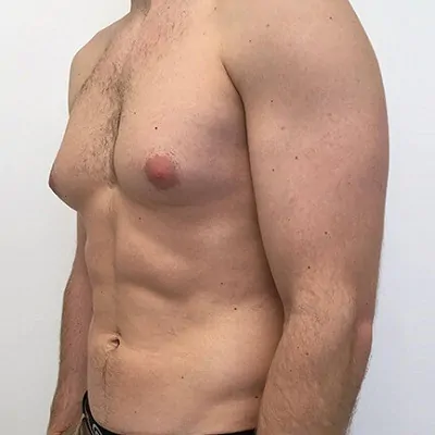 What to Expect Before and After Surgery