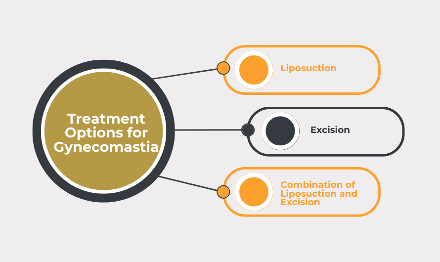Treatment Options for Gynecomastia in Mumbai