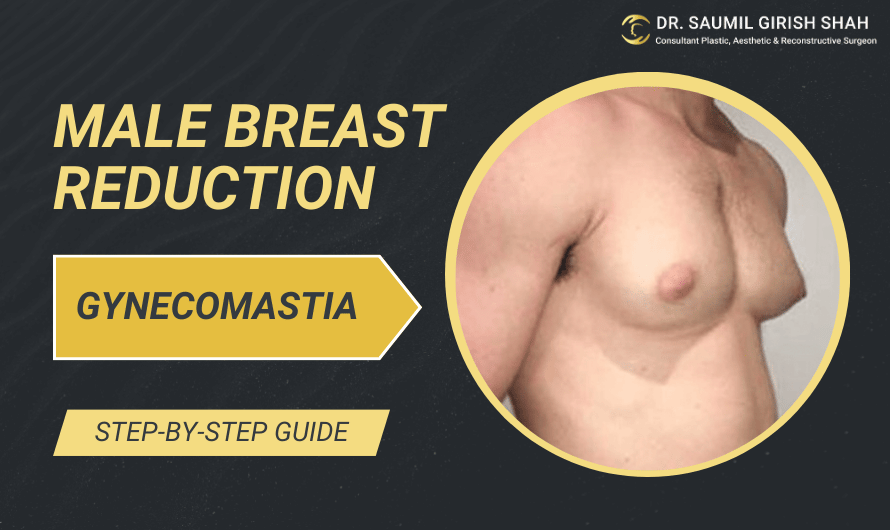 A Step-by-Step Guide to Gynecomastia Surgery in Mumbai