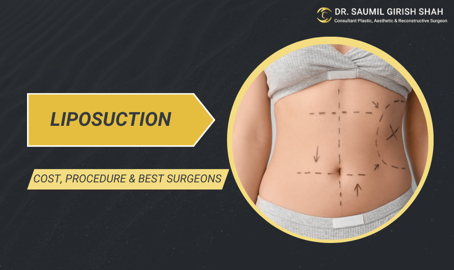 Liposuction in Mumbai: Cost, Procedure & Best Surgeons