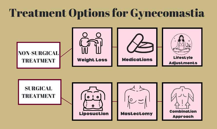 Treatment Options for Gynecomastia