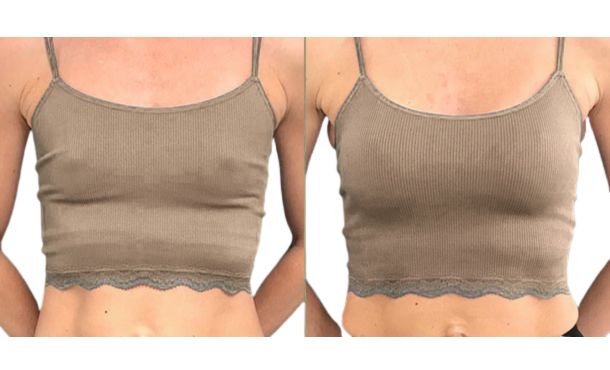 What Is Mini Breast Augmentation and How Does It Work?