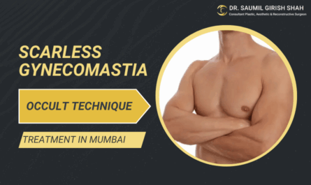 Scarless Gynecomastia Treatment with Occult Technique in Mumbai