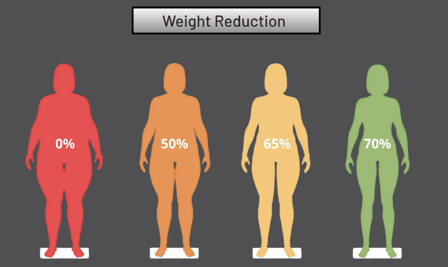 Weghtloss by Weightloss Injection