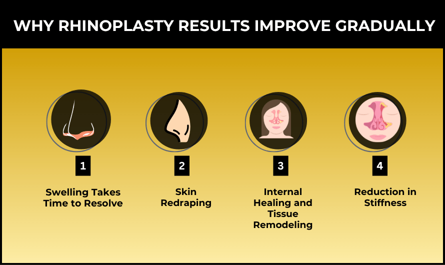 Why Rhinoplasty Results Improve Gradually
