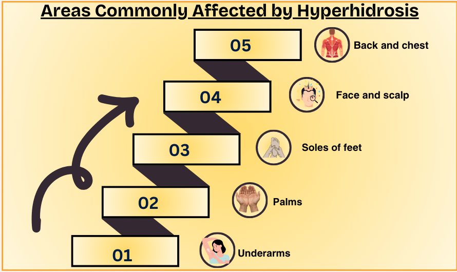 Areas Commonly Affected by Hyperhidrosis