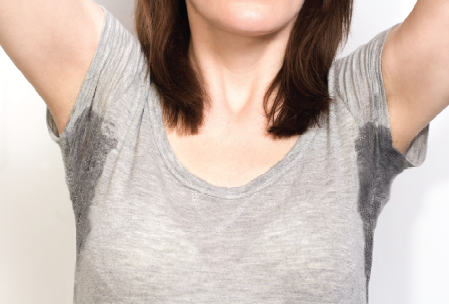 Can Excessive Sweating Be Treated?