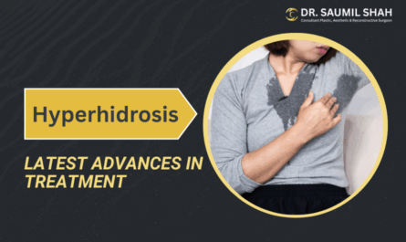 Latest Advances in Hyperhidrosis Treatment