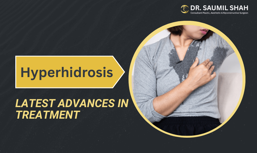 Latest Advances in Hyperhidrosis Treatment You Should Know About
