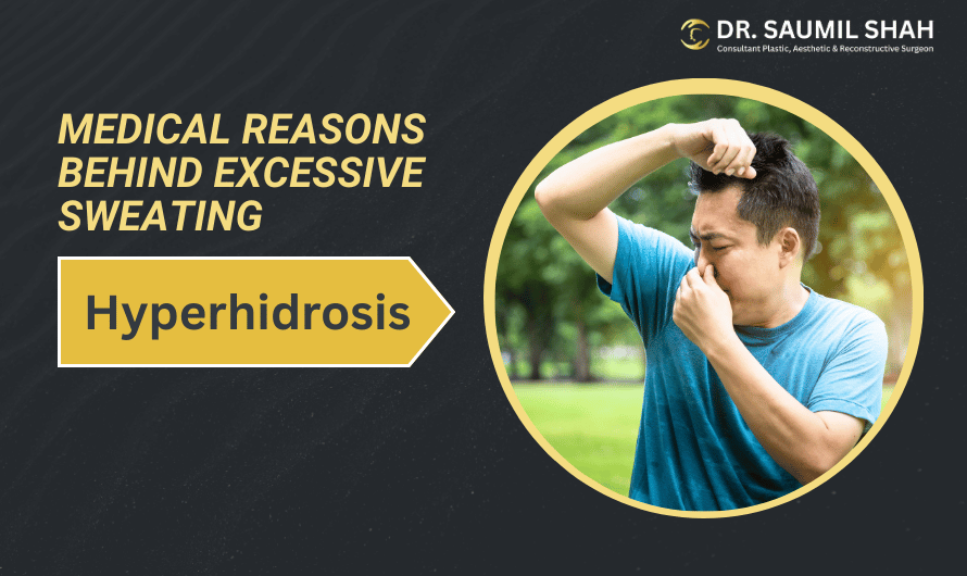 Why Do I Sweat So Much? Medical Reasons Behind Excessive Sweating (Hyperhidrosis)