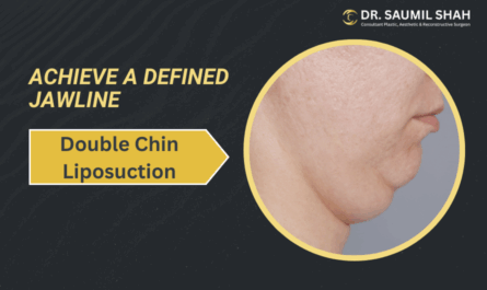 Achieve a Defined Jawline with Double Chin Liposuction
