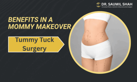 The Benefits of Tummy Tuck Surgery in a Mommy Makeover